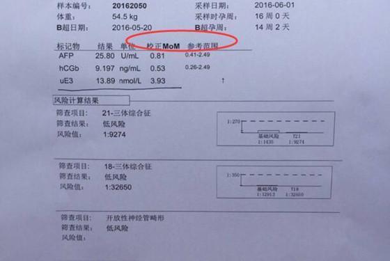 产科检查时的AFP(ECLIA)是什么？测试项目afp-图3